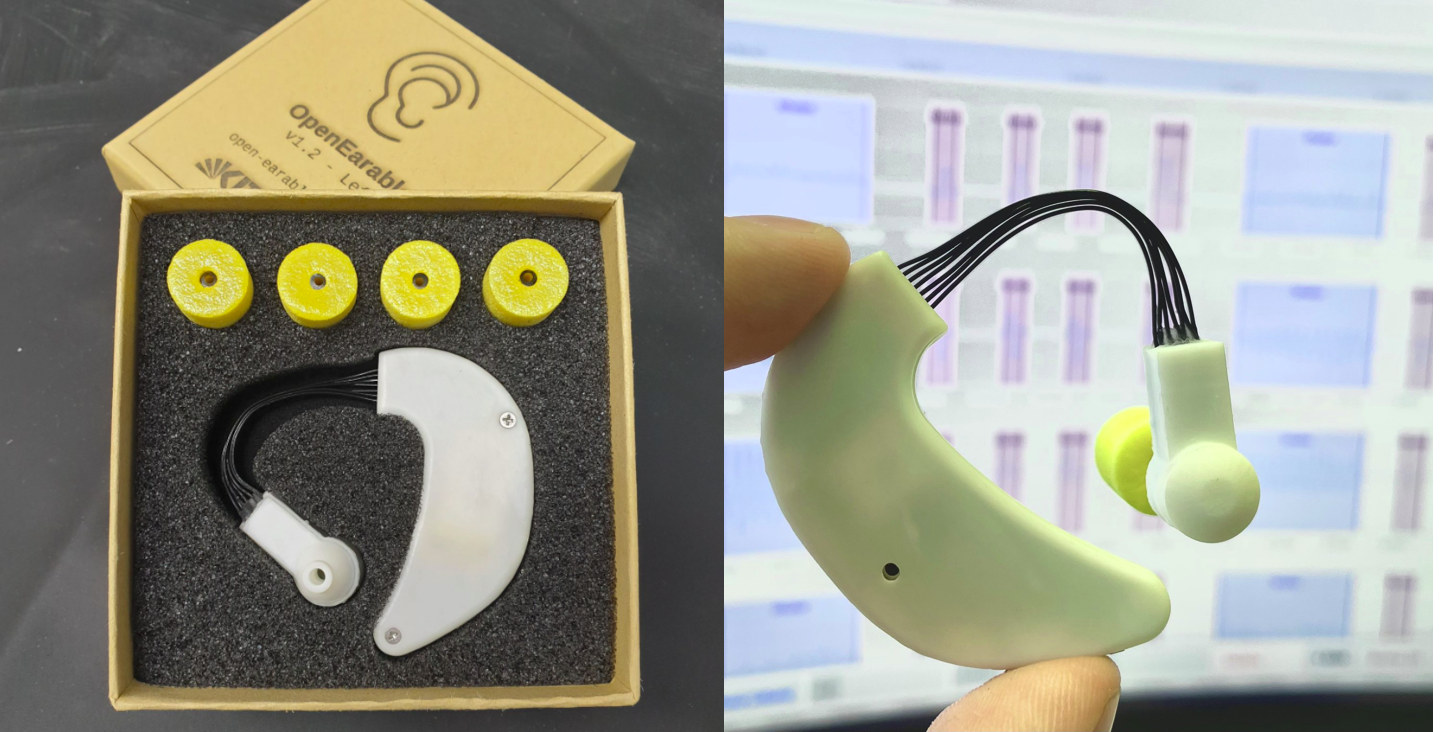 Open Earable Device (c) KIT